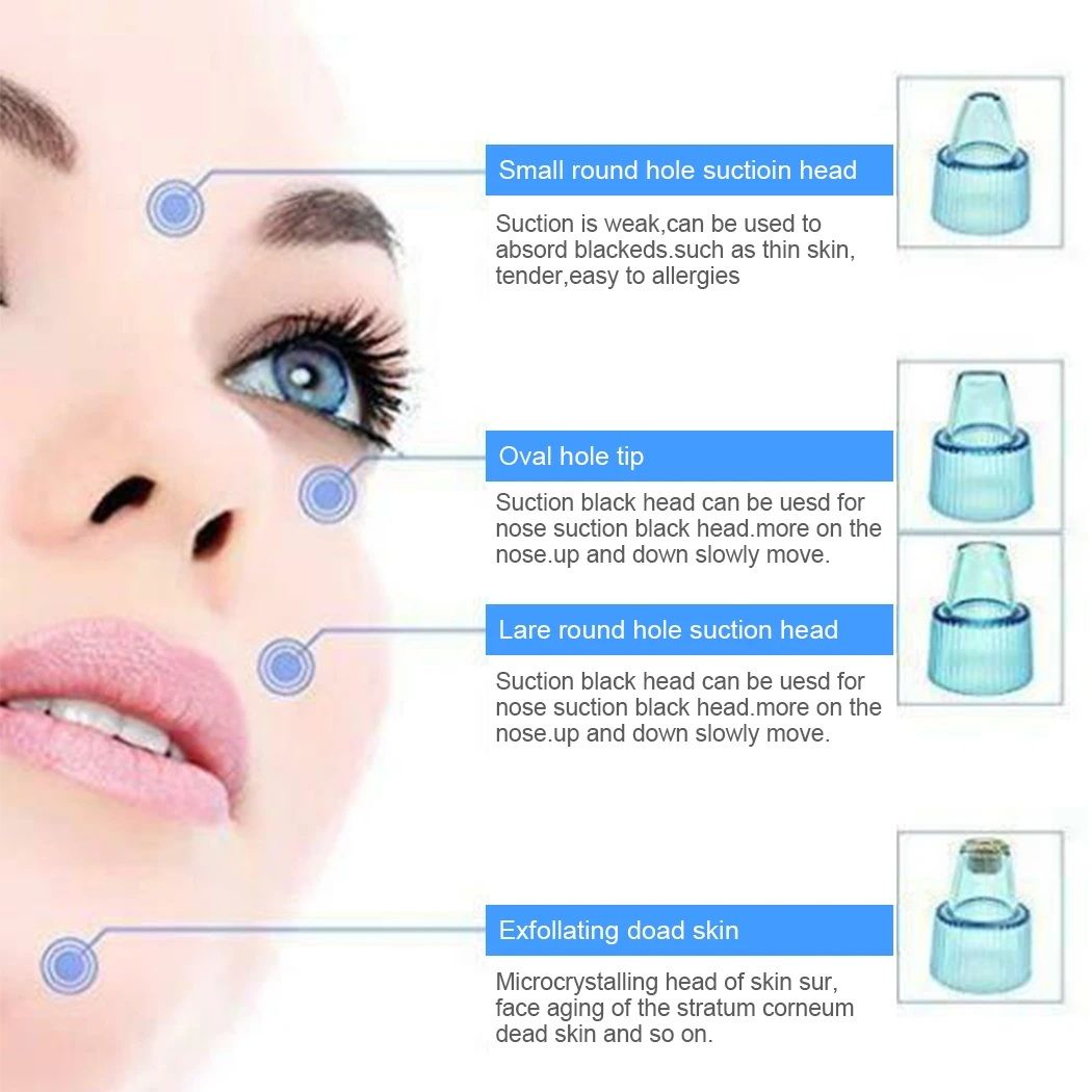 Cell Operated Blackhead Removal Machine Derma Suction 4 In 1 Black Head Remover Machine